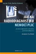 Maxdorf Jak na radiodiagnostiku nemoc plic