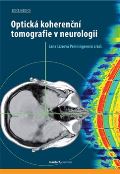 Maxdorf Optick koherenn tomografie v neurologii