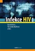 Maxdorf Infekce HIV