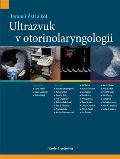 Maxdorf Ultrazvuk v otorinolaryngologii