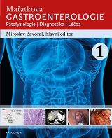 Karolinum Maatkova gastroenterologie