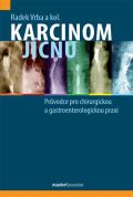 kolektiv autor Karcinom jcnu