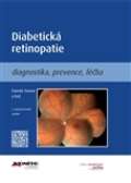 kolektiv autor Diabetick retinopatie