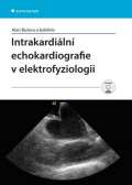 Grada Intrakardiln echokardiografie v elektrofyziologii + DVD