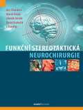 Maxdorf Funkn stereotaktick neurochirurgie